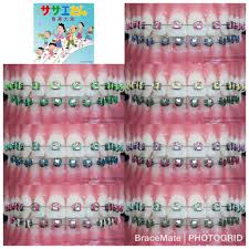 Check spelling or type a new query. Color Palette For Braces
