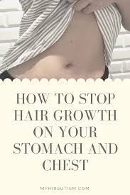 The child, from kemerovo, russia, would chew hair when she was nervous. Unwanted Hair On Chest And Stomach Can Be So Frustrating And Really Take A Toll On Your Self Confidence Is Chest Hair Growth Hair Removal Women Unwanted Hair
