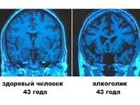 Порой диагнозы, которые ставят близким, пугают родственников. Toksicheskaya Encefalopatiya Prichiny Simptomy Diagnostika I Lechenie