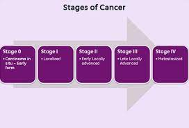 The stage of a cancer describes how far the cancer has grown and spread at the time of diagnosis. Understanding Cancer Metastasis Stages Of Cancer And More