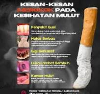 Pejabat - [KESAN-KESAN MEROKOK 🚬 PADA KESIHATAN MULUT ...