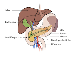 Operation Am Bauchspeicheldrusenschwanz Pankreas Erkrankungen Therapien Allgemein Viszeral Tumorchirurgie Uniklinik Koln