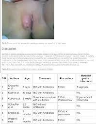Image result for Bartholin's gland abscess