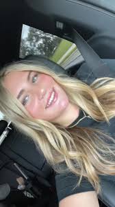 Braces Removal Transition Video Surprise