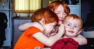 Red Hair Blue Eyes How Common Is The Genetic Combination