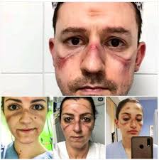 hero #covid19 #coronavirus #healthcareheroes #nurses  #healthcareprofessionals