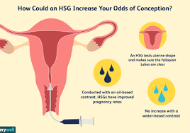 How old do you have to be to get your tubes tied? Will An Hsg Help You Get Pregnant