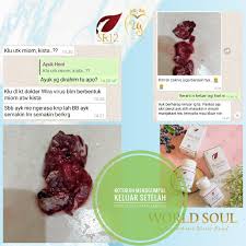 Maybe you would like to learn more about one of these? Pelancar Haid Ampuh Manjakani Aceh Sr12 Herbal Obat Keputihan Kista Promil Bpom Shopee Indonesia