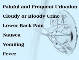 Kidney Stone Symptoms In Women Kidney Stones Symptoms Kidney Stones Symptoms Woman Kidney Stones