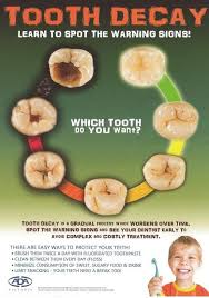 Tooth Decay Learn To Spot The Warning Signs Dentist Dental Hygienist Dentaltown Quotes Ortodontia Higiene Dental Carie Dentaria