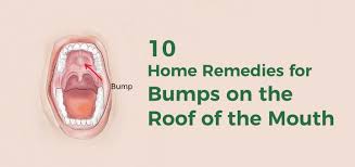 They are the same size that one of the. Bumps On The Roof Of The Mouth 10 Causes Effective Home Remedies