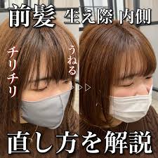 生え際 くせ毛 前髪