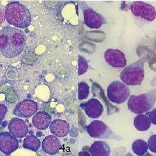 It is an incredibly hard decision to make, but your veterinarian. Microscopic Pictures Showing The Typical Cytological Appearance Of A Download Scientific Diagram