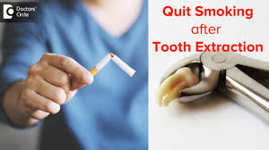 Sep 18, 2020 · how long do i have to wait to smoke after tooth extraction? Do I Need To Quit Smoking After Tooth Extraction Prevent Dry Socket Dr Rizwana Tarannum Youtube