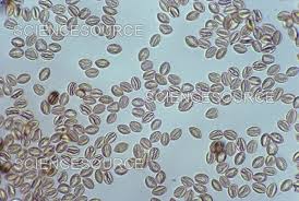 Image result for Stemonitis fusca