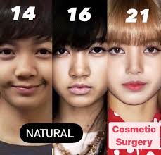 Lisa dei Blackpink ha avuto un "glow down"? Ho sentito da molte persone che  ultimamente sembra "botched", non ci credevo fino a quando non ho visto  l'ultima foto. Le foto sono dal