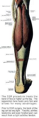 Pain along the inside of the foot and ankle, where the tendon lies. Achilles Tendonitis Information And Available Treatments Feet For Life Podiatry Foot Doctor In St Louis And Chesterfield Mo