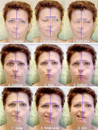 Bell's palsy is a condition that causes a temporary weakness or paralysis of the muscles in the face. How To Assess The Condition Of Your Face After Bell S Palsy Crystal Touch Bell S Palsy Clinic