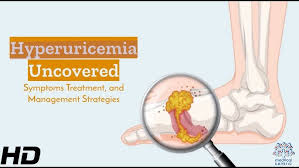 Image result for Hyperuricemia