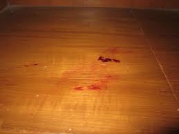 Damp mop your hardwood floors with a microfiber mop. Close Up Of Dried Blood Picture Of Top North Hotel Chiang Mai Tripadvisor