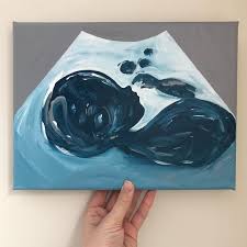 Pin On Ultrasound Art