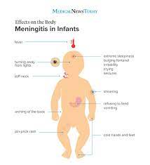 Treatments and medications for meningitis in kids. Meningitis In Babies Symptoms And Treatment