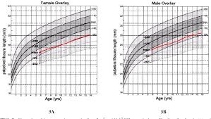 Figure 3 From Canadian Palpebral Fissure Length Growth