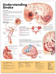 Understanding Stroke Anatomical Chart 2nd Edition