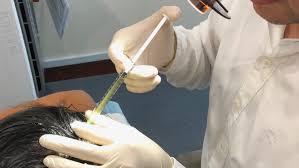 Platelet rich plasma prp contains high levels of. Platelet Rich Plasma Prp Peter Ch Ng Skin Specialist Kl Malaysia