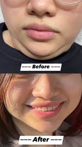 Gluta Beauté Lounge Floridablanca