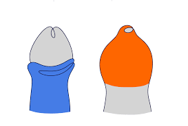 Image result for Phimosis