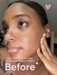 20 top Natural Beauty Hacks for Glowing Skin ideas in 2024