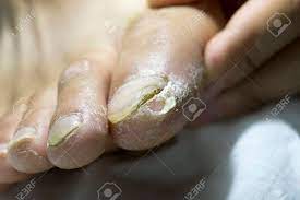 マクロの足の汚い男性指の写真素材・画像素材 Image 83856273