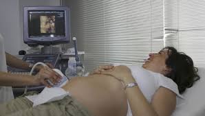 It's also when you can find out the gender, if you care to know. Meeting Your Baby What To Expect During Your First Ultrasound