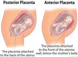 Things To Know About An Anterior Placenta Aseky Co