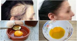 A Magic Recipe For The Fastest Hair Growth You Only Need 3 Ingredients Hair Growth Faster Hair Remedies For Growth Hair Growth Treatment