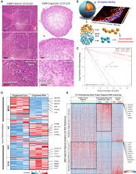 Yo maps mary you x d yo maps mary you x d dalis… Altered Lipid Metabolism Marks Glioblastoma Stem And Non Stem Cells In Separate Tumor Niches Acta Neuropathologica Communications Full Text