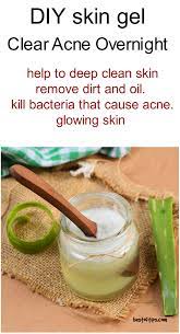 Pin By Aia Emam On Best Tips Clear Acne Overnight Acne Overnight Clear Acne
