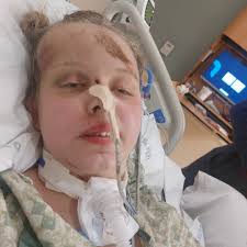 Fundraiser for Misty Walker by Austin Smith : Support Chloe's Critical  Recovery Journey