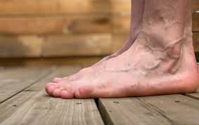 A bone spur is a painful bump on the top of the foot, which is a bony enlargement. Why You Re Experiencing Pain On Top Of Your Foot Feet First Clinic