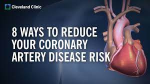 8 Ways To Reduce Your Coronary Artery Disease Risk | Cleveland Clinic -  Youtube