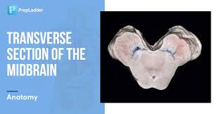 Image result for Midbrain
