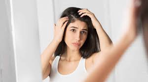 Further, inadequate amount of water leads to less moisture in the body. Dry Scalp Hair Loss Dr Serkan Aygin Clinic