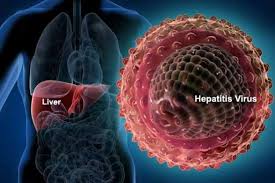 Virus hepatitis juga ada beberapa jenis: Gejala Hepatitis B Akut Dan Kronis Apa Perbedaannya