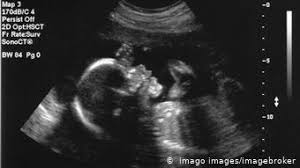 Wann sie das erste ultraschallbild vom baby erhalten? Baby Kino Wie Gefahrlich Ist Ultraschall Furs Kind Wissen Umwelt Dw 17 05 2019