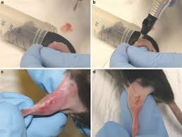 Body modification like tattooing or piercing can stimulate an immune response that you might not so if you plan on getting any of the covid vaccines, just as a precaution, save the tattoos for another. Intradermal Vaccination By Dna Tattooing Springerlink