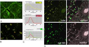 Borrowed from french nuance (nuance, shade, hue). Example Of Spectral Unmixing Using Nuance 12 13 Ffpe Tissue Sections Download Scientific Diagram