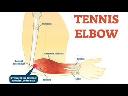 Correction of lateral elbow pain while golfing is easy only when we have corrections to the swing. Tennis Elbow Rehab Exercises Stretches Tennis Training With Coach Dabul Youtube