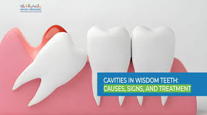 Best Options To Fix Snaggletooth Teeth - Infoteeth