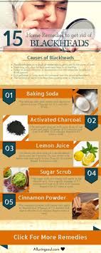 Pin On Remove Blackheads Naturally